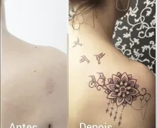 Cobertura de cicatriz na região posterior do ombro