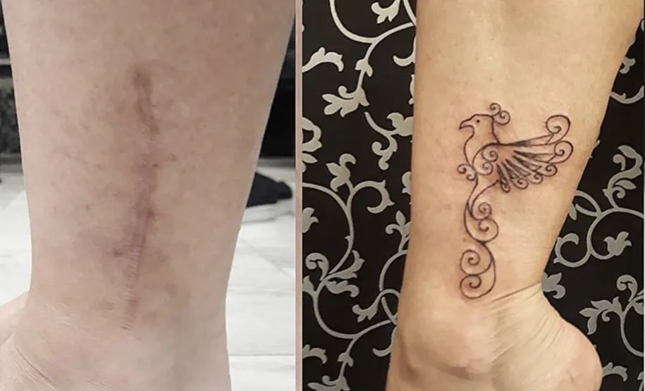 Cobertura de cicatriz